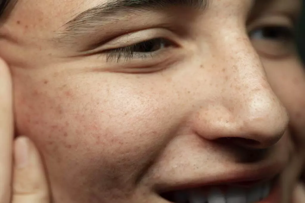 Close-up of a person's face showing the side profile with visible skin texture, small freckles, and a faint smile—an excellent example for those considering cosmetic tattoos like freckle tattoos.